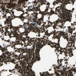 Ankyrin 1 Antibody, Novus Biologicals 0.1mL; Unlabeled:Antibodies, Polyclonal